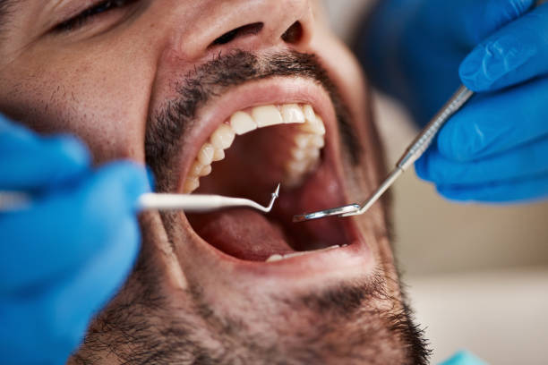 Best After-Hours Dental Trauma Care in West Falls Church, VA